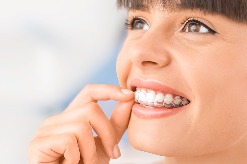 Invisalign in Lawrenceville