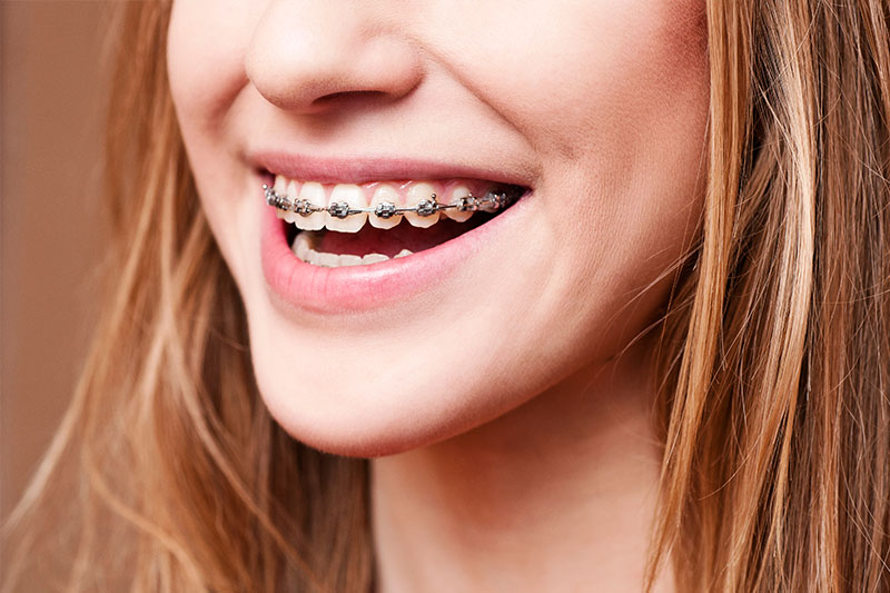 Orthodontics in Lawrenceville